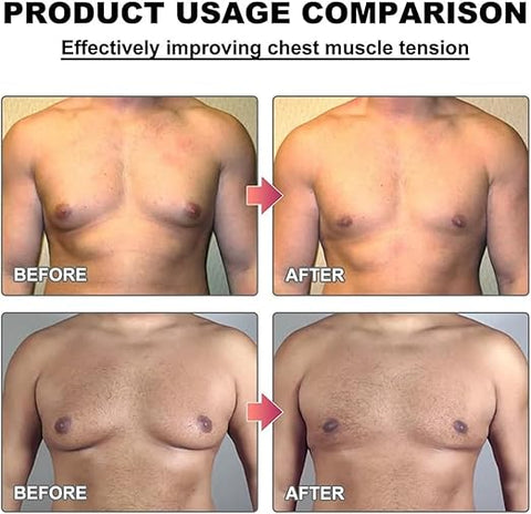 Men Therm - Bee Venom Gynecomastia Heating Oil (Original)