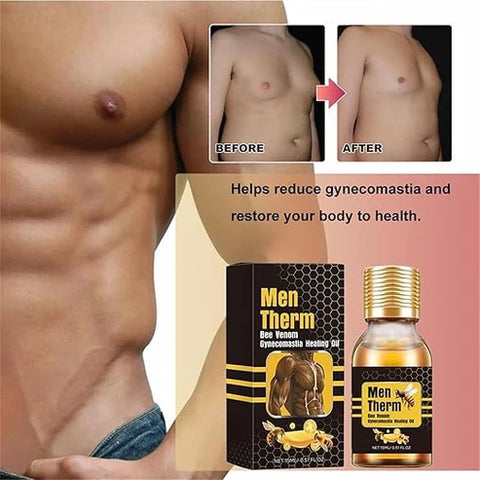 Men Therm - Bee Venom Gynecomastia Heating Oil (Original)